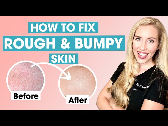 How To Fix Rough and Bumpy Skin | Keratosis Pilaris Affordable Skincare Routine