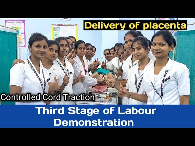 Active Management of Third Stage of Labour/ AMTSL full Procedure /Demonstration/Delivery of Placenta