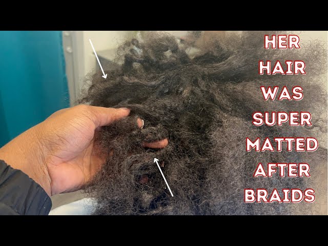 Her hair loc'd after removing braids | How to detangle tangled hair | Matted hair from braids