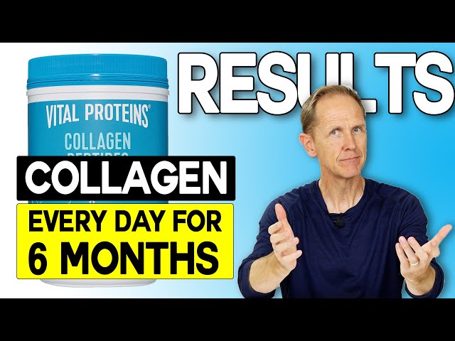 Vital Proteins Collagen Peptides | Results