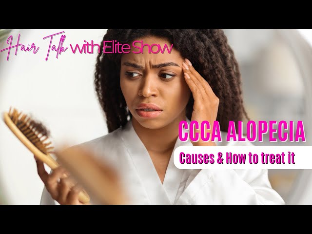 Dealing with CCCA Alopecia? Causes, Treatments & Hair Care Tips for Regrowth! Hair Talks with Elite