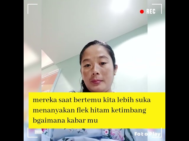 FLEK HITAM||Menakutkan Bagi Banyak Orang||