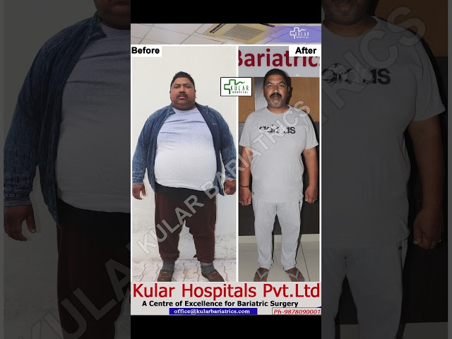 Unfit to fit, Lost 63 Kg with Mini gastric bypass surgery? @kskular