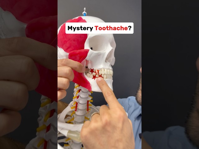 Mystery tooth ache? It could be a muscle! #tmj