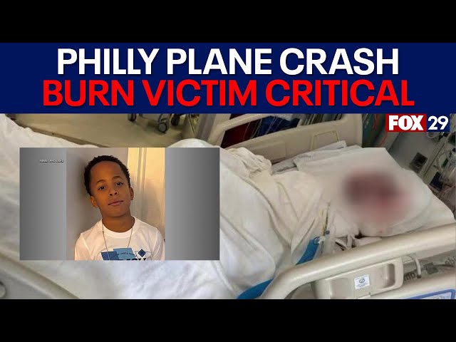 Philly plane crash: 9-year-old boy badly burned in critical condition at Boston hospital