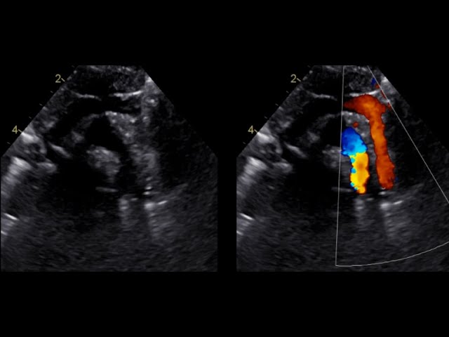 Case 1 " Pediatric Echo Quizzes Series "