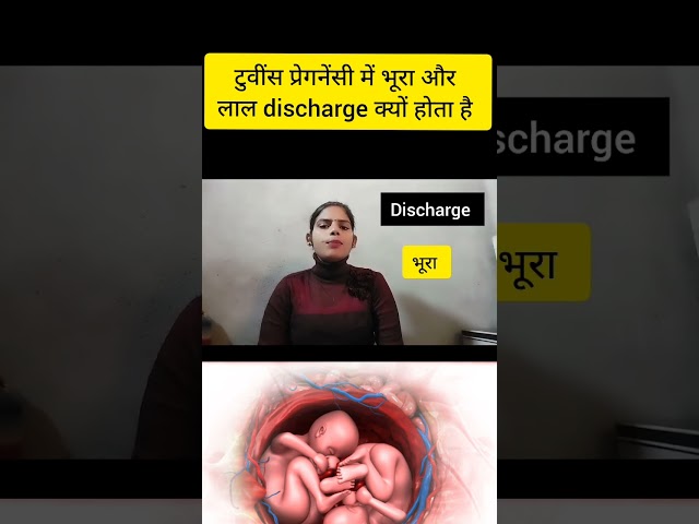 Twins pregnancy me bhura or laal discharge kyu hota hai red or brown discharge in twins pregnancy