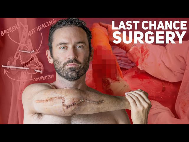 Last Chance Surgery: Saving My Arm