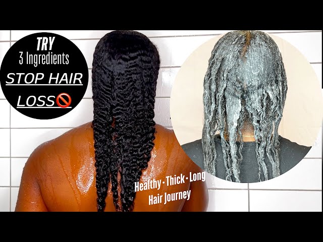 Mixed 3 Ingredients To Stop My Hair From Falling Out | Getting Thicker Longer Hair