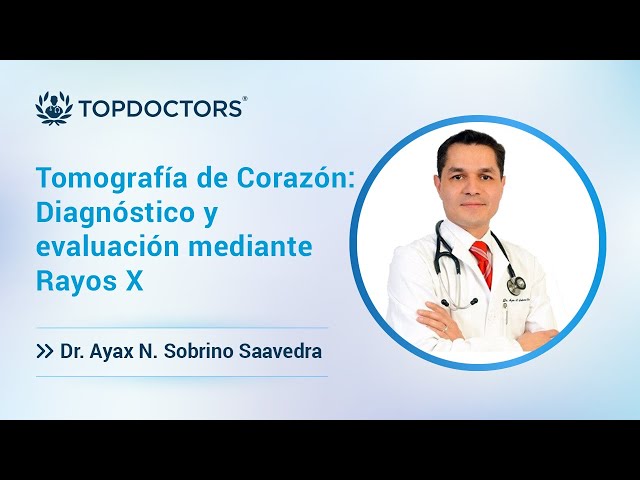 Tomografía de Corazón: Diagnóstico y evaluación mediante Rayos X