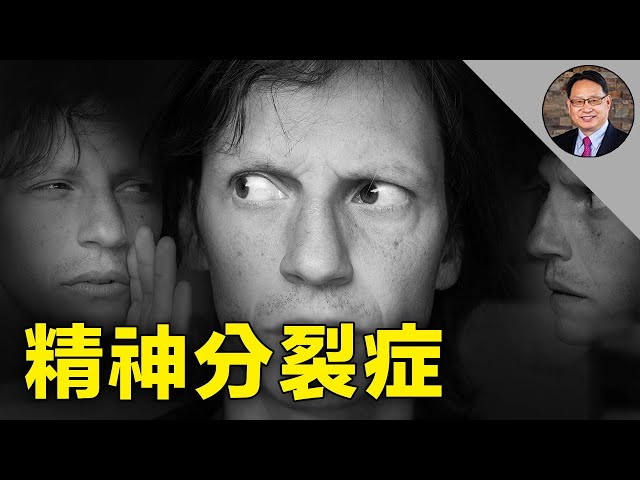 經常被誤解的精神分裂症（思覺障礙)，楊醫師給你一次講清楚。