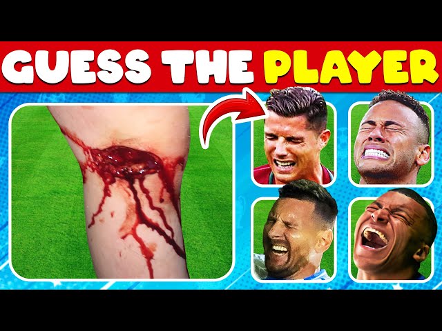 YOU witnessed the WORST INJURIES in Football History!🩸Who Got INJURY?| Football 2025| Ronaldo, Messi