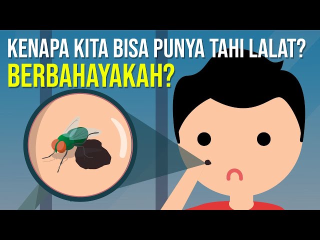 Kenapa kita bisa punya tahi lalat? Berbahayakah?