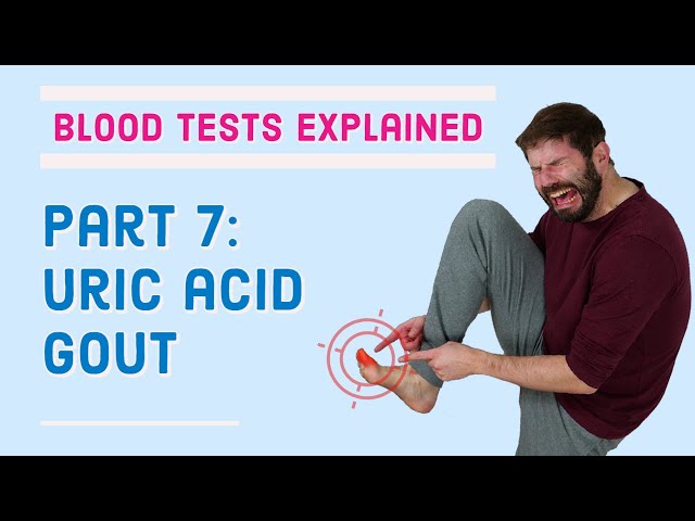 Gout, Uric Acid Blood Test - What does it mean?