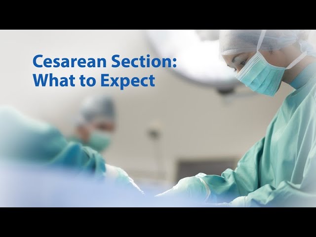 Cesarean Section: What to Expect