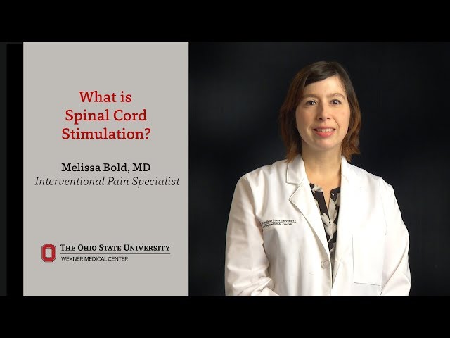 What is spinal cord stimulation? | Ohio State Medical Center