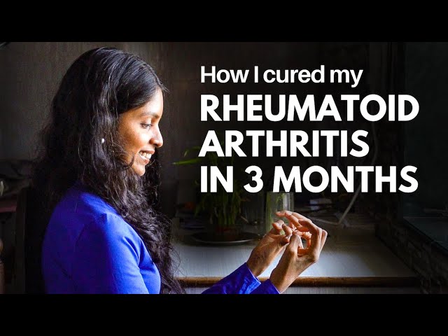 10-Year Old Rheumatoid Arthritis Gone in 3 Months | Satvic Movement