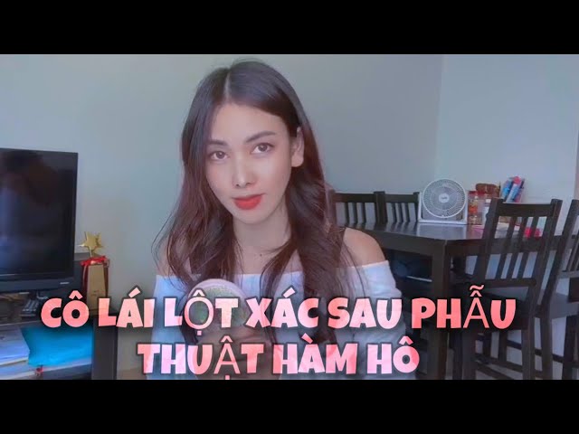 LỘT XÁC sau PHẪU THUẬT hàm hô hàm móm ( Phẫu thuật hàm hô hàm moms)