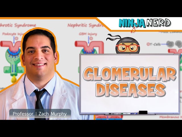 Glomerular Diseases | Clinical Medicine