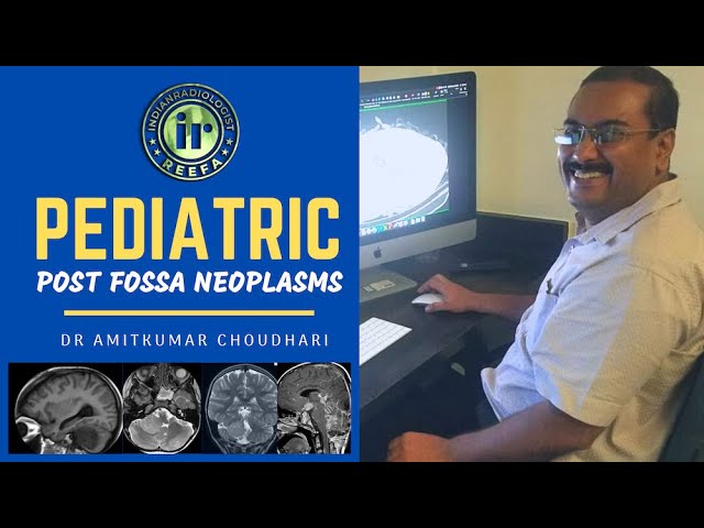 PEDIATRIC POSTERIOR FOSSA NEOPLASMS | AMITKUMAR CHOUDHARI | MR IMAGING | MEDULLOBLASTOMA | GLIOMA