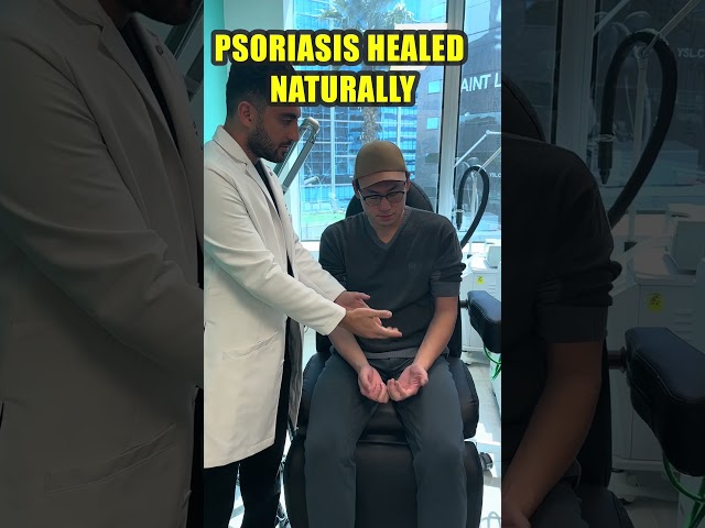 Psoriasis Healed Naturally with Regenerative Medicine