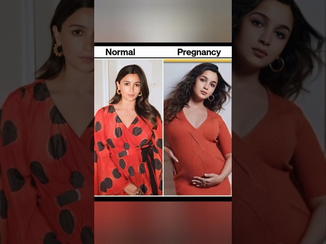 Normal pregnancy actress #shortvideo