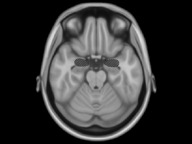 Cognitive neuroscience of music | Wikipedia audio article