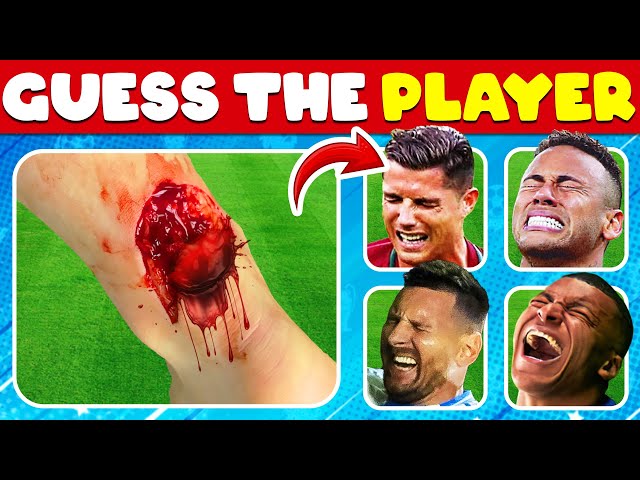 YOU witnessed the WORST INJURIES in Football History!🩸Who Got INJURY?| Football 2025| Ronaldo, Messi