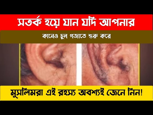 আপনি সতর্ক হয়ে যান যদি আপনার কানে চুল গজায় | কানে চুল হলে কি হয় | জুবায়ের বিন ইমাম | islamic dua