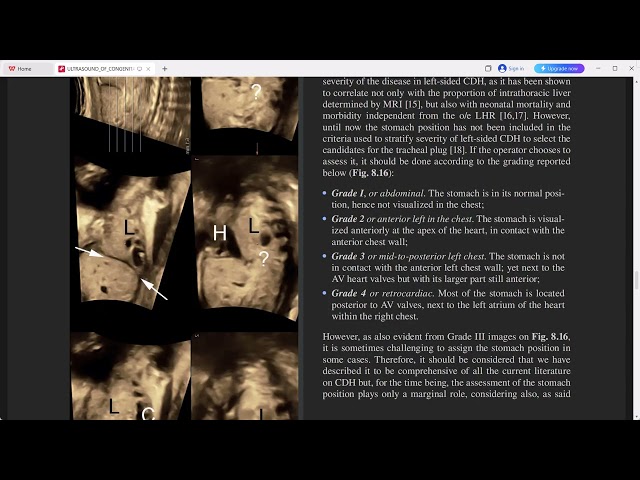 ULTRASOUND OF CONGTENIGTAL ANOMALIES