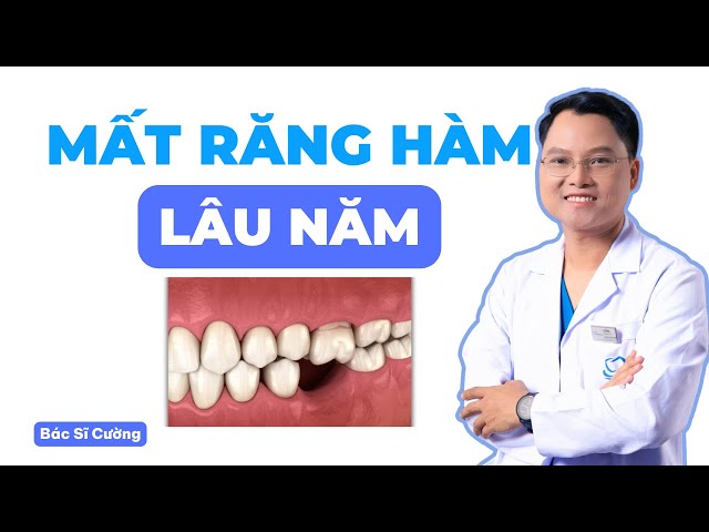 Mất Răng Hàm Lâu Năm Và Giải Pháp | Bác sĩ Cường