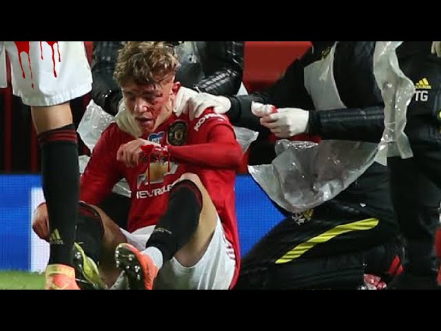 Brandon Williams Head Injury | Brandon Williams Head Injury During Match | Brandon Williams injury