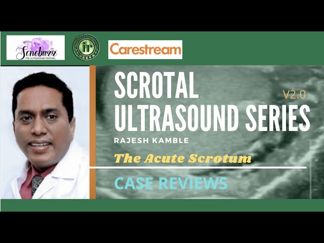 ACUTE SCROTUM - CASE BASED REVIEW || RAJESH KAMBLE || Cases & Discussion