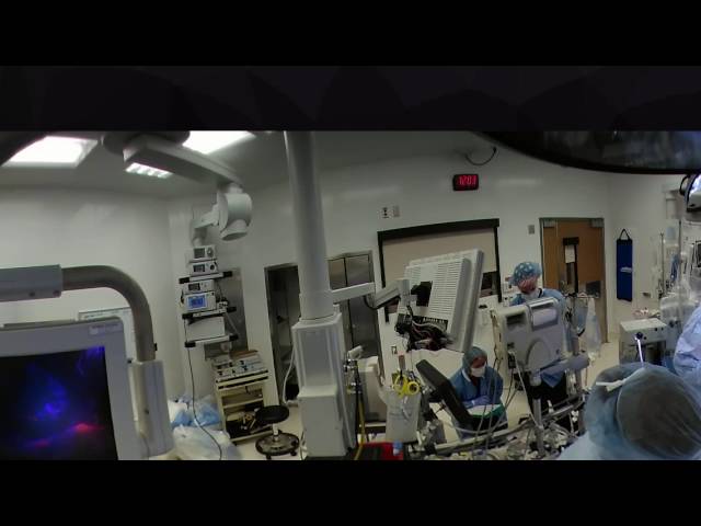 360° CABG (VR)