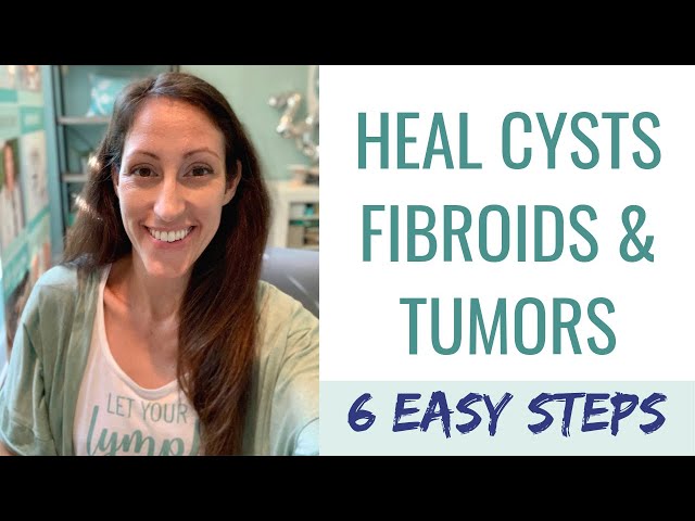 6 Ways To Heal Thyroid Dysfunction & Cure Tumors, Cysts, Fibroids and Goiters in Your Body