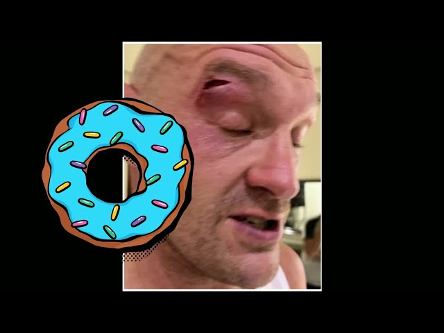 Tyson Fury sparring cut