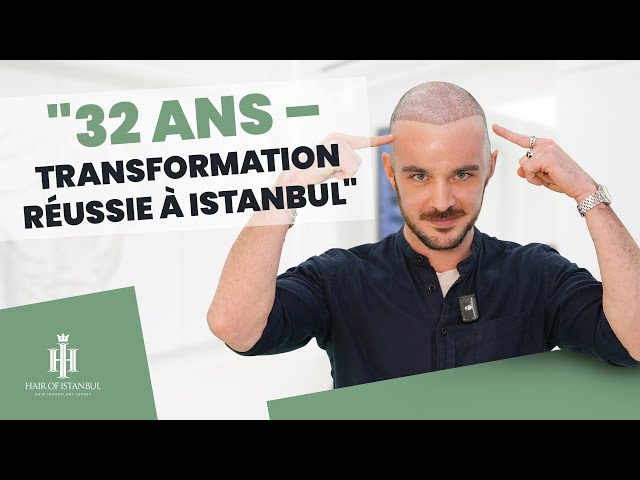 "De France à Istanbul : Mon Expérience de Greffe Capillaire avec Hair of Istanbul"