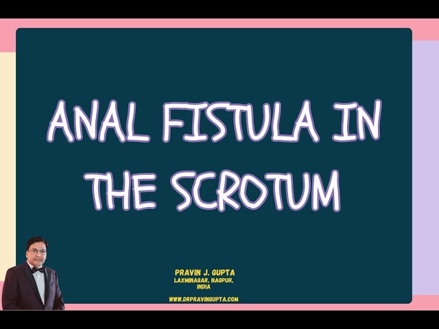 ANAL FISTULA IN THE SCROTUM