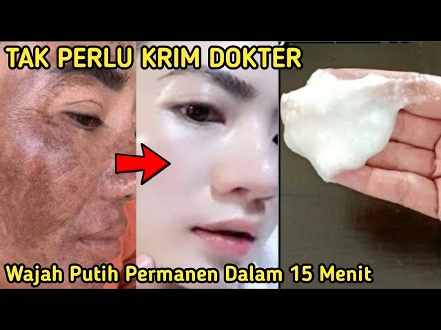 NYESEL BARU TAU SEKARANG!! OLES BAHAN INI WAJAH HITAM JDI PUTIH SEKETIKA?! MEMUTIHKAN WAJAH PERMANEN