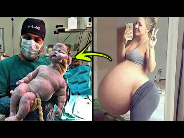 10 Truly Unusual Childbirths Which Even Doctors Did Not Believe