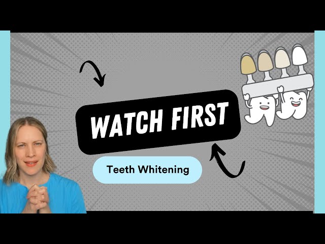 Starting A Teeth Whitening Business: For Non-Dental Professionals