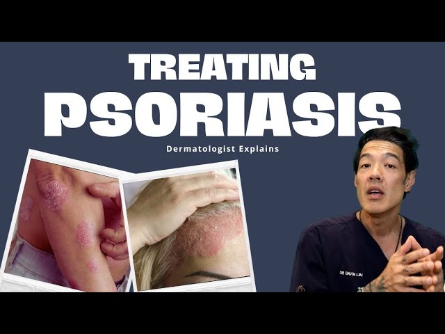 What is Psoriasis? and how to treat it | Dr Davin Lim