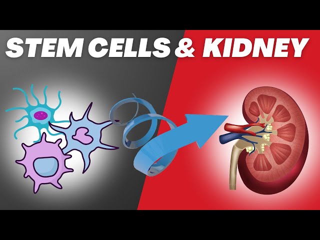 Would STEM CELL be the FINAL CURE for all kidney diseases? | AwaisZaka.com | Episode 156