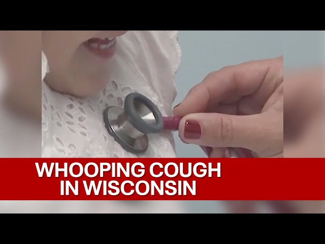 Whooping cough cases in Wisconsin; states ranks 3rd in nation | FOX6 News Milwaukee