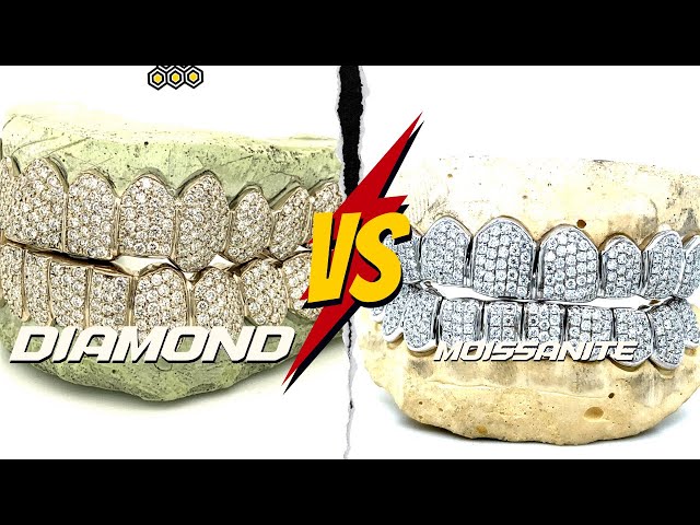 Diamond Grillz vs Moissanite Grillz: Which is Worth Your Money?