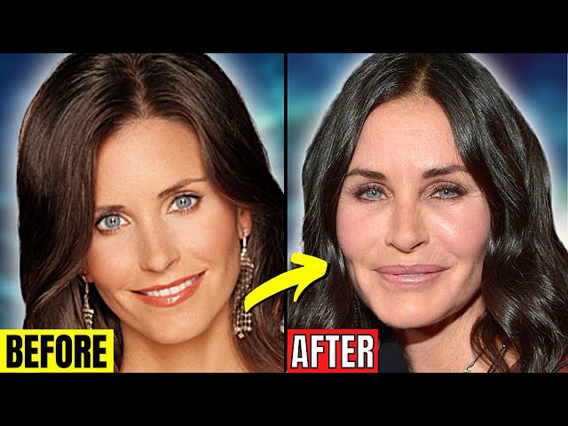 6 Celebrity Surgeries Gone Wrong