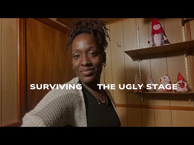 Don’t Comb Out Your Locs! | Tips For Surviving The Ugly Stage | Loc Tips | DIY Microlocs |