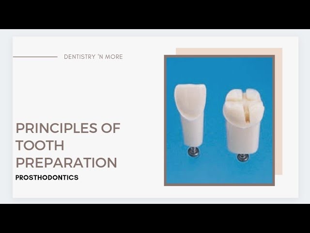 PRINCIPLES OF TOOTH PREPARATION