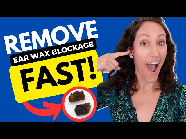 How to Remove Ear Wax Blockage Fast | DIY Ear Drop Recipe (FREE)