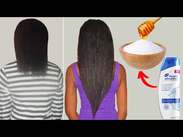 just mix this ingredient in your shampoo your hair will grow 4 cm daily, hair tips